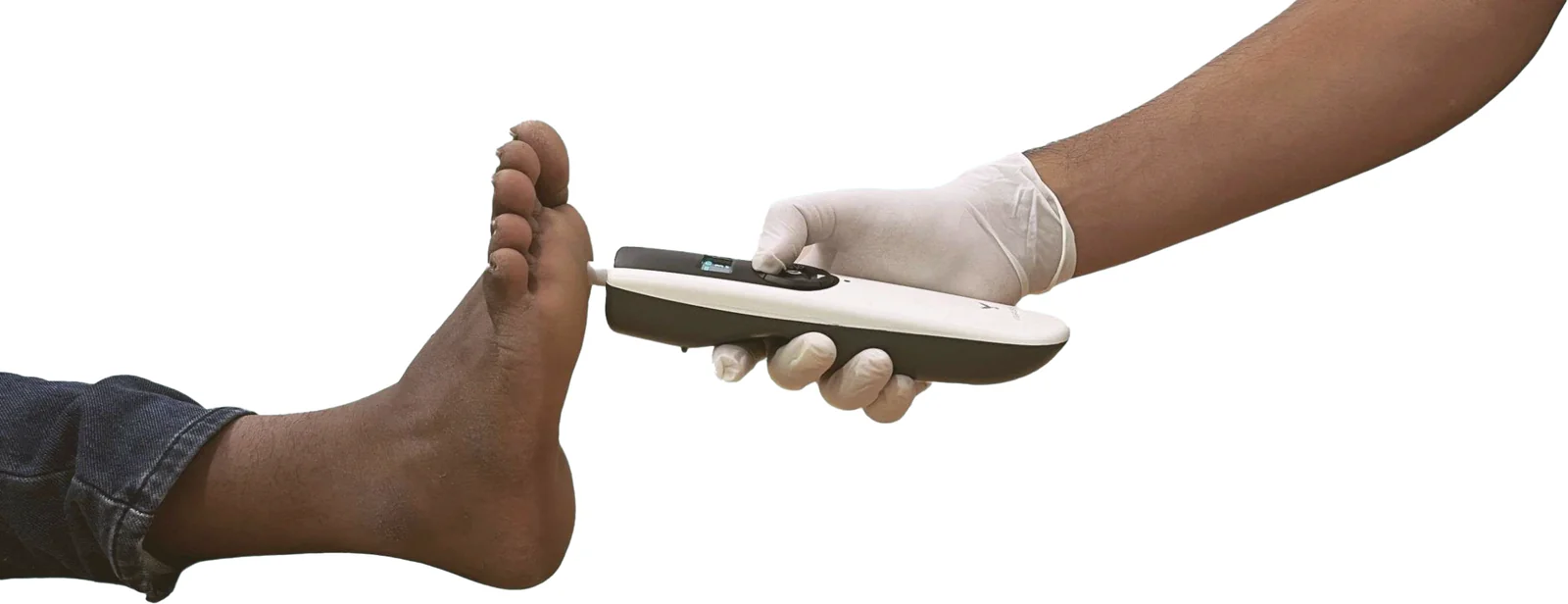 A gloved hand holding the Vibrasense with its probe against the big toe of a bare foot